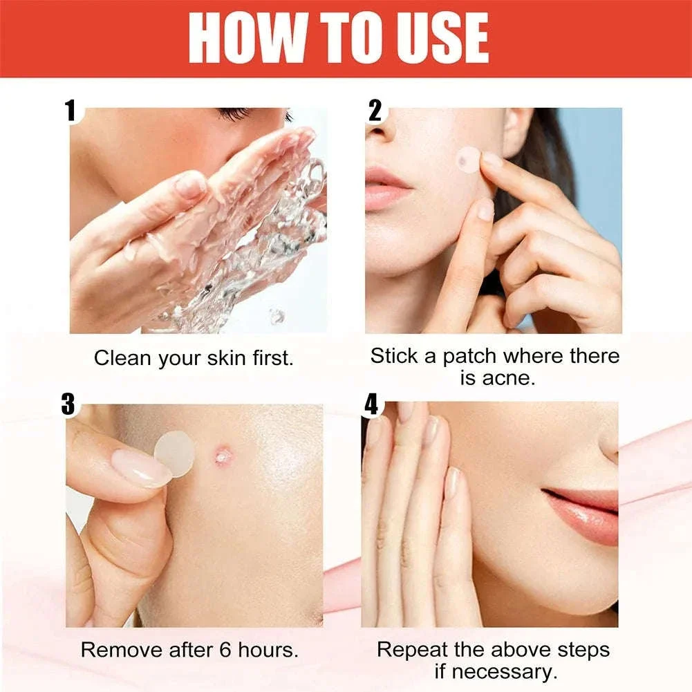 Acne Patches in Heart, Star, Flower & Round Shapes, 240 pcs - Image 5
