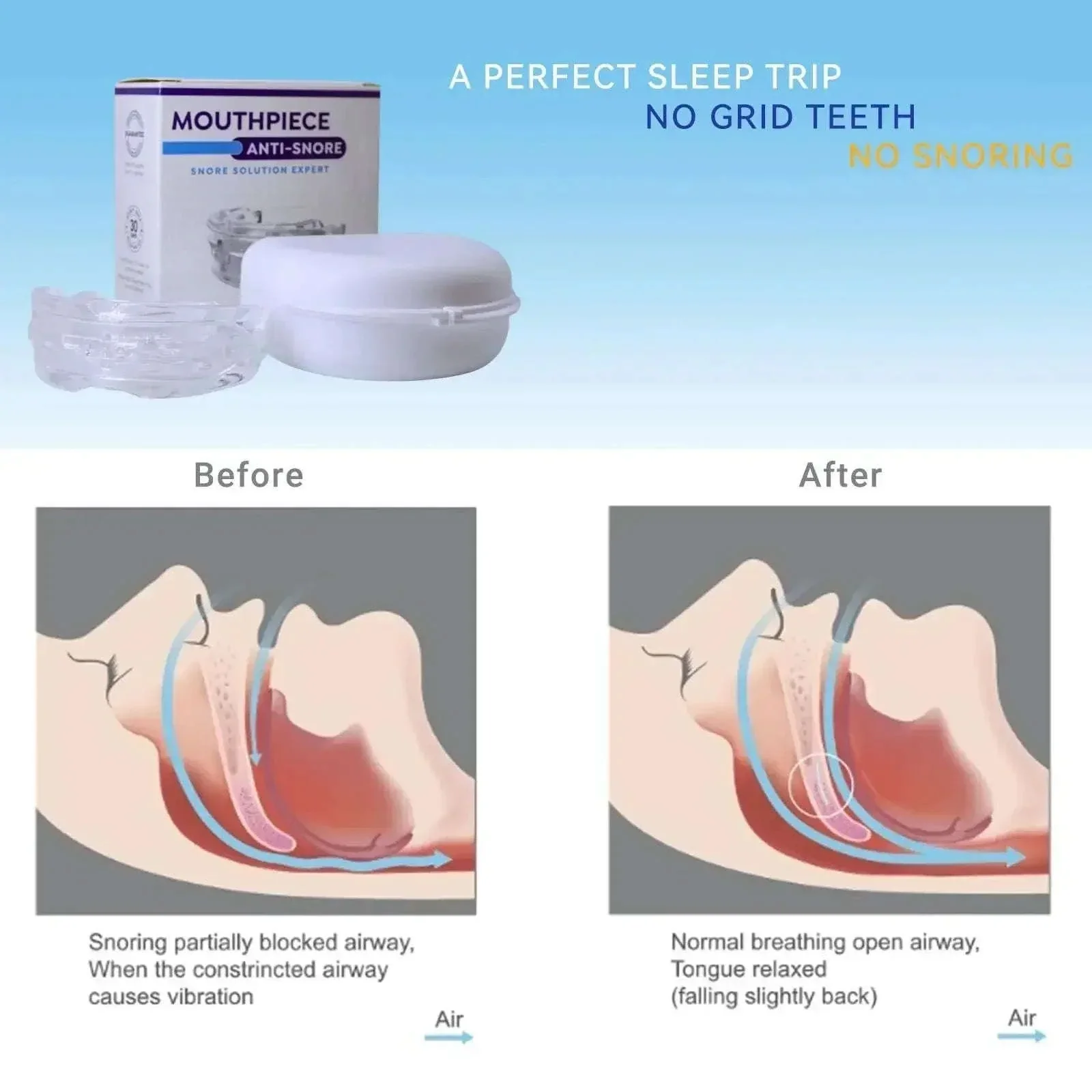 Adjustable Anti-Snoring Mouthpiece for Bruxism & Better Sleep - Image 4