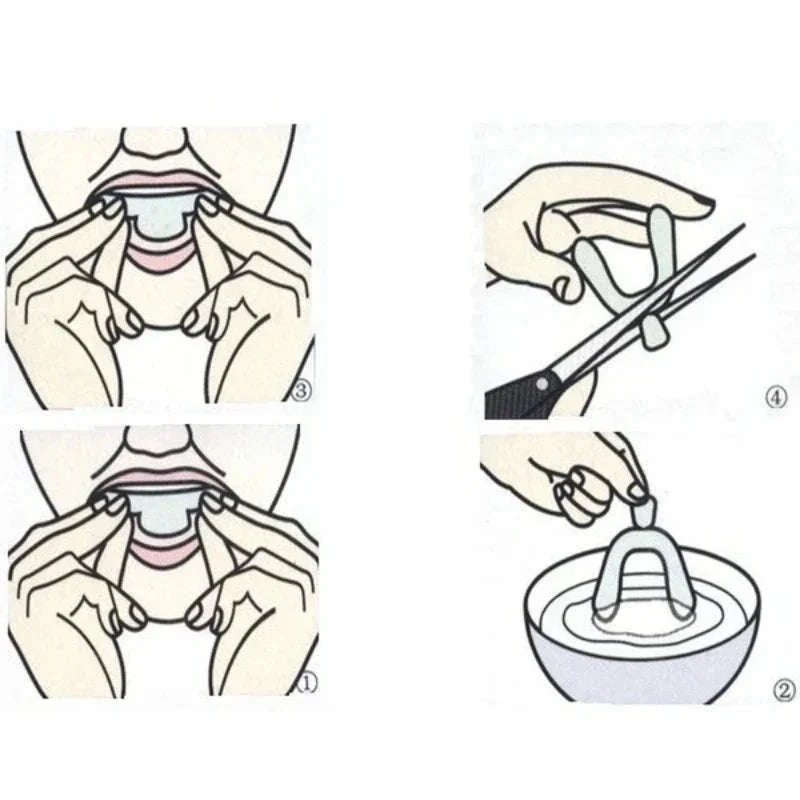 Anti Snoring Mouth Guard for Teeth Grinding Custom Fit Night Guard Set - Image 6
