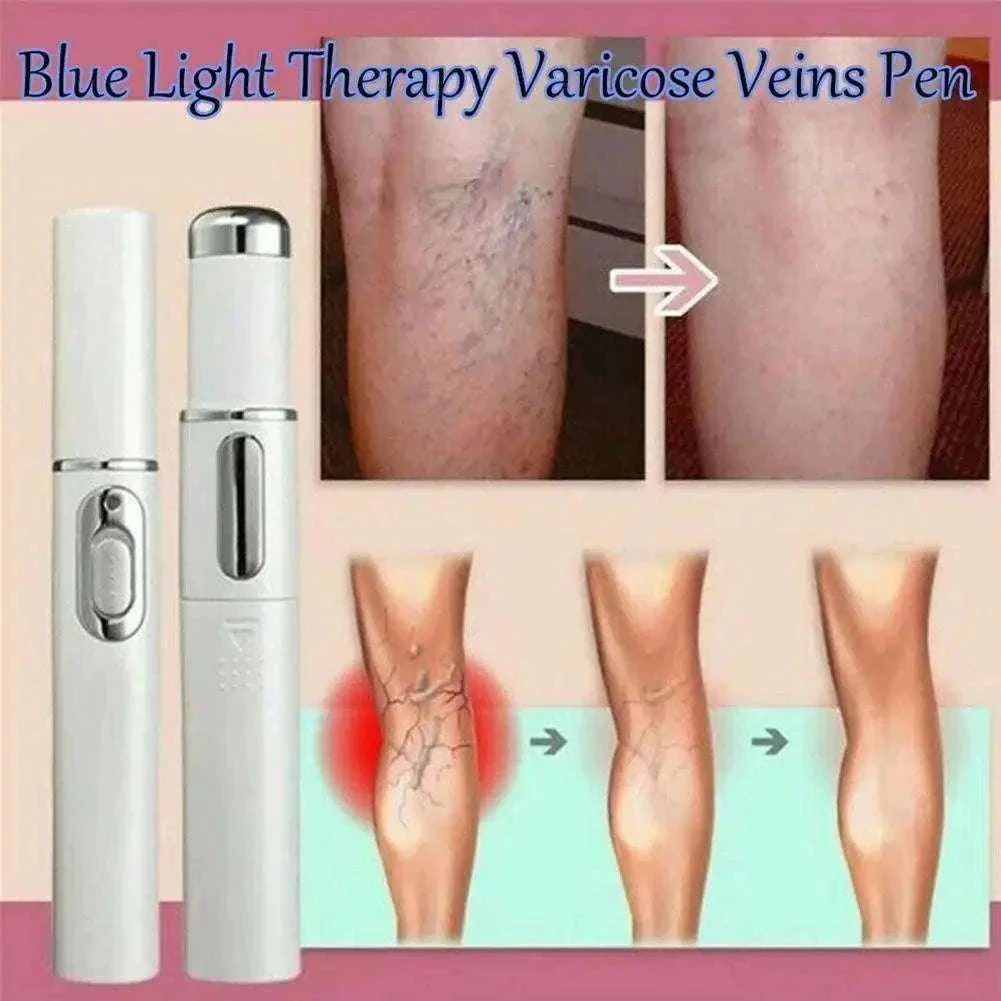 Blue Light Therapy Acne Pen for Targeted Blemish Care - Image 20