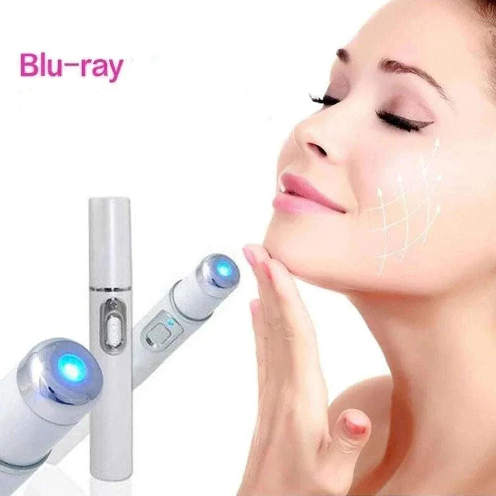 Blue Light Therapy Acne Pen for Targeted Blemish Care - Image 3