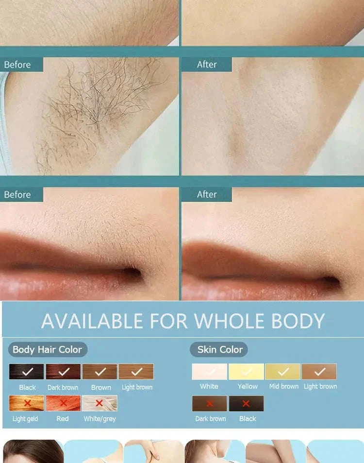 Body Bikini IPL Hair Removal Device, 500K Flashes - Image 15