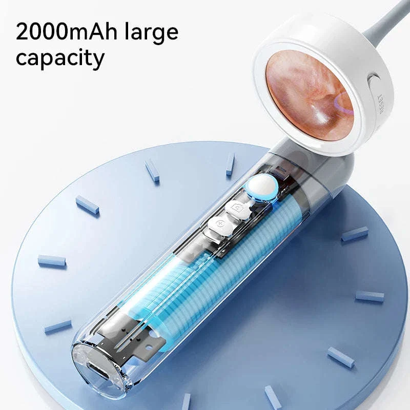 1080P Ear Camera Otoscope with 1.38" Screen and 4 LEDs - Image 6