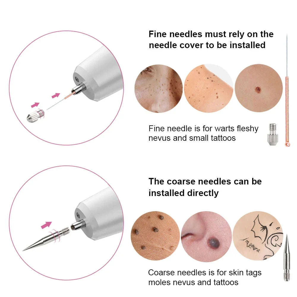 Laser Plasma Pen for Targeted Skin Application - Image 6