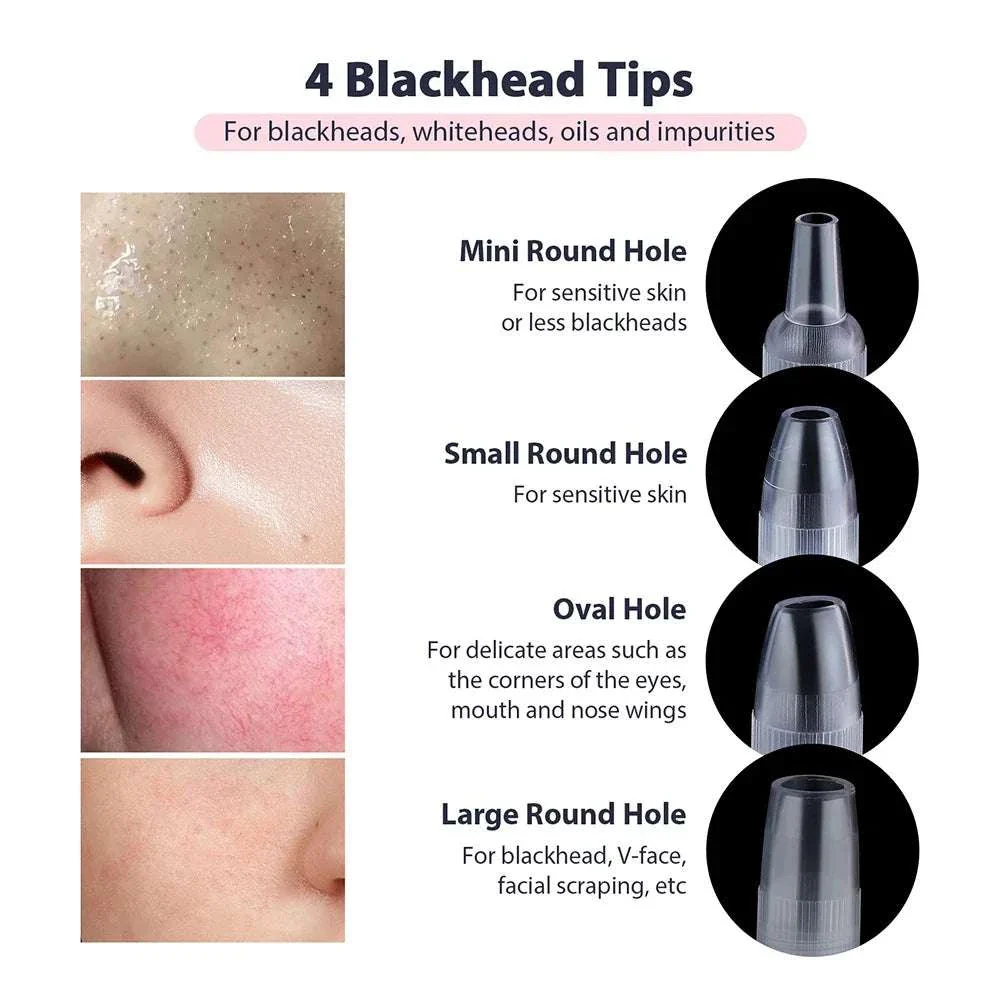 Diamond Microdermabrasion Machine for Deep Facial Exfoliation - Image 27