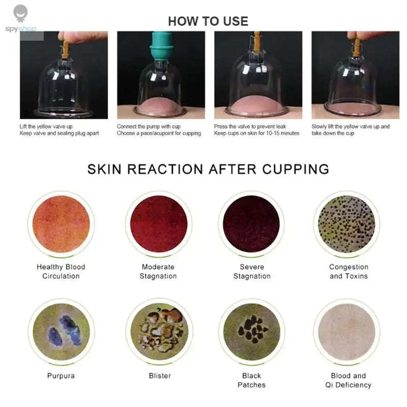 Vacuum Suction Cups for Body Massage and Relaxation - Image 4