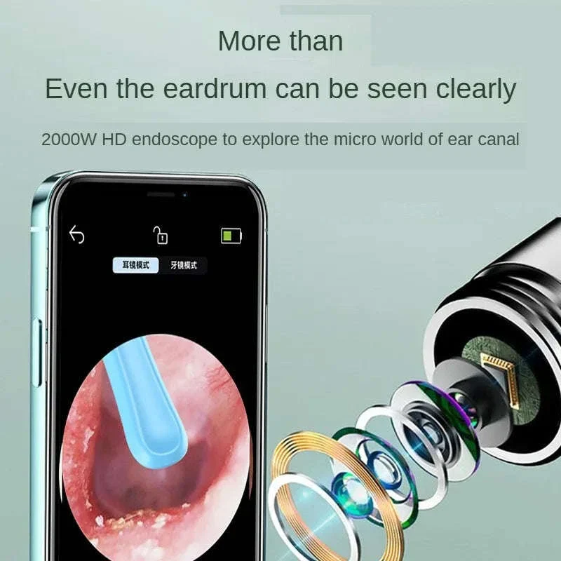 Wireless Ear Cleaner with Camera – Visual Ear Wax Removal Tool - Image 2